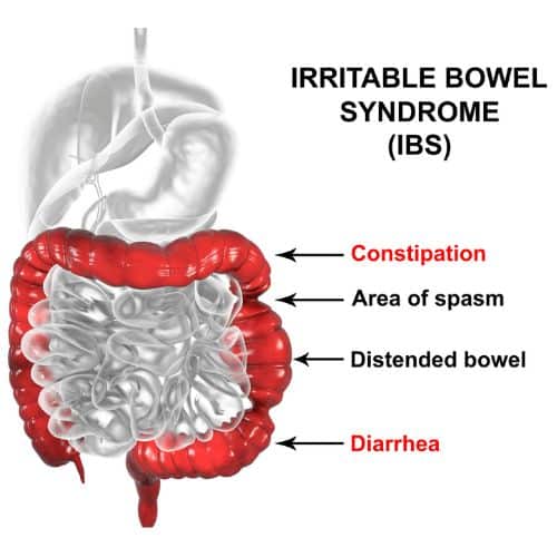 IBS labelled diagram